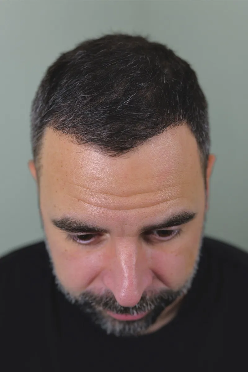 After D.