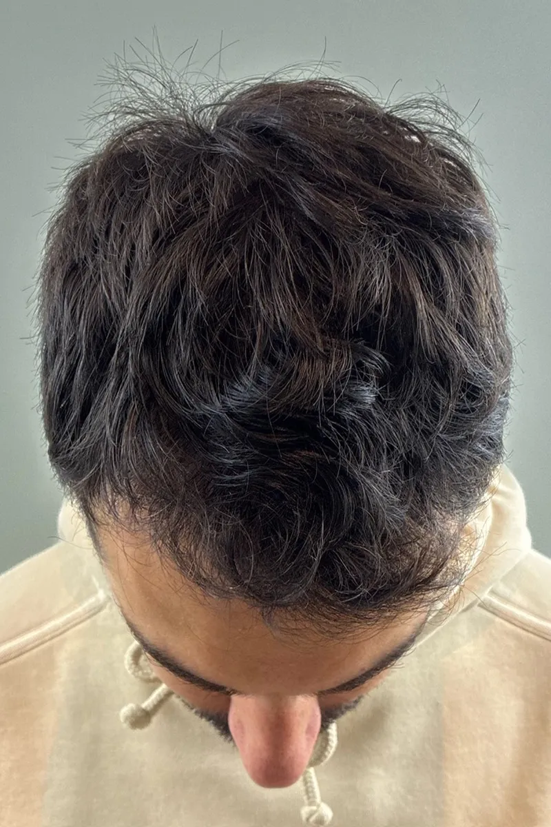 After M.