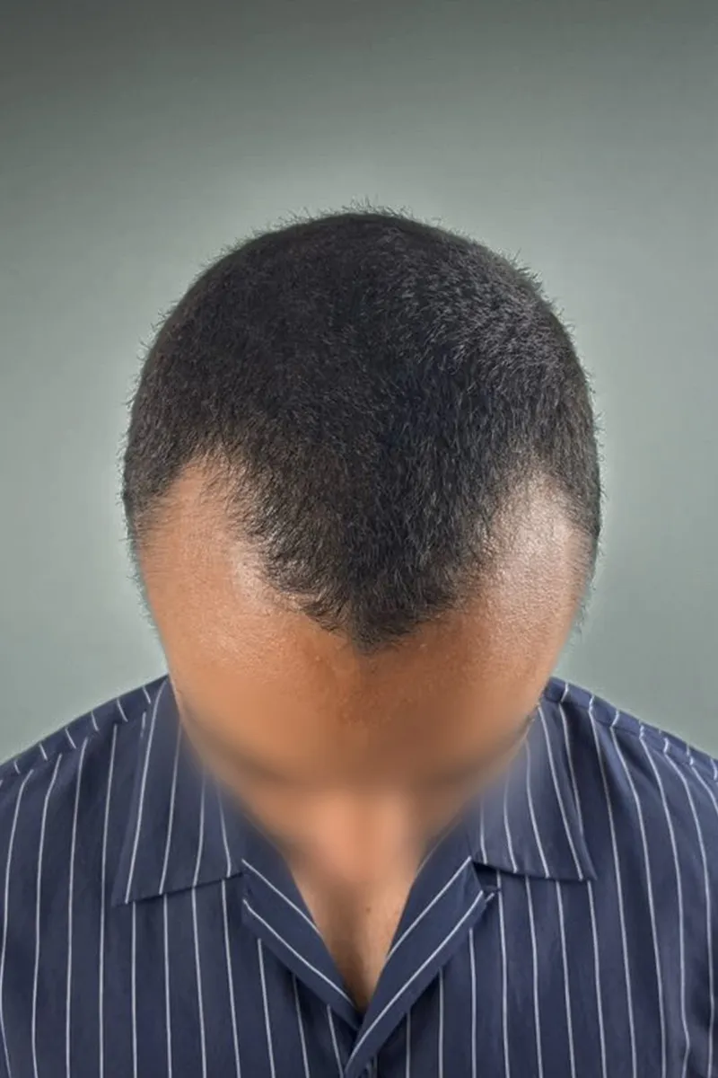 Before D.