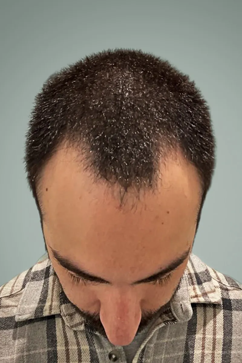 Before M.